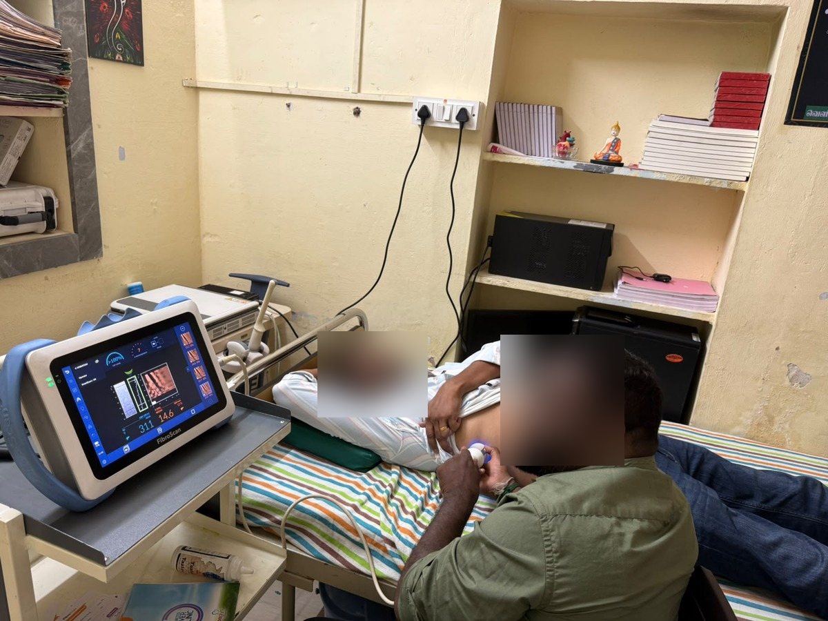 முகாமில் ஒருவருக்கு Fibroscan கல்லீரல் பரிசோதனை செய்யப்படுகிறது